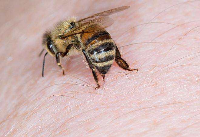 làm gì khi trẻ bị ong đốt, trẻ bị ong đốt có nguy hiểm không?