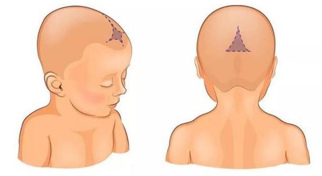 Có nên che thóp trẻ sơ sinh Có nên che thóp trẻ sơ sinh, tìm hiểu về thóp trẻ sơ sinh